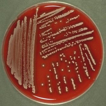 اثر کشنده پروبیوتیک ها بر باکتری های مقاوم به آنتی بیوتیک!