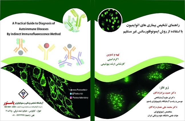 راهنمای تشخیص بیماری های اتوایمیون 