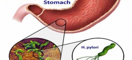 هلیکوباکترپیلوری