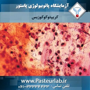 کریپتوکوکوزیس